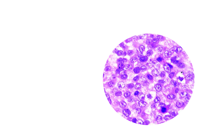 Photo of Miguels Tumor - OUANO - MASKED